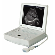 Professioneller Ultraschallscanner für medizinische Laptops (THR-LT001)